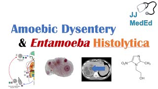 Amebiasis Amoebic Dysentery  Entamoeba histolytica Pathogenesis Signs amp Symptoms Treatment [upl. by Ybba]