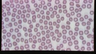 Blood Smear Evaluation [upl. by Emory]