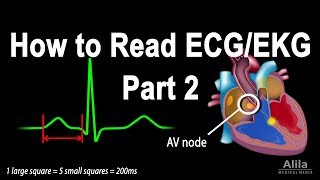 How to Read ECGEKG Part 2 Animation [upl. by Enitsirhc]