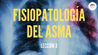 3 FISIOPATOLOGÍA DEL ASMA FISIOPATOLOGÍA RESPIRATORIA [upl. by Mansfield]