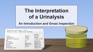 Interpretation of the Urinalysis Part 1  Introduction and Inspection [upl. by Ajidahk]