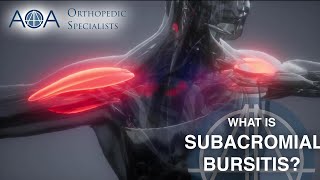 AOA Orthopedic Specialists  Subacromial Bursitis [upl. by Roselle993]