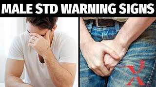 Common STDs Warning Signs amp Symptoms of Viral STDs [upl. by Nrublim]