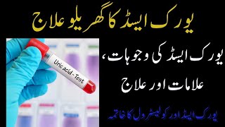 Uric Acid Treatment  Uric Acid ka ilaj by Hakeem Imran Kamboh [upl. by Anined]