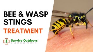 How to Treat Bee and Wasp Stings [upl. by Ludwog789]